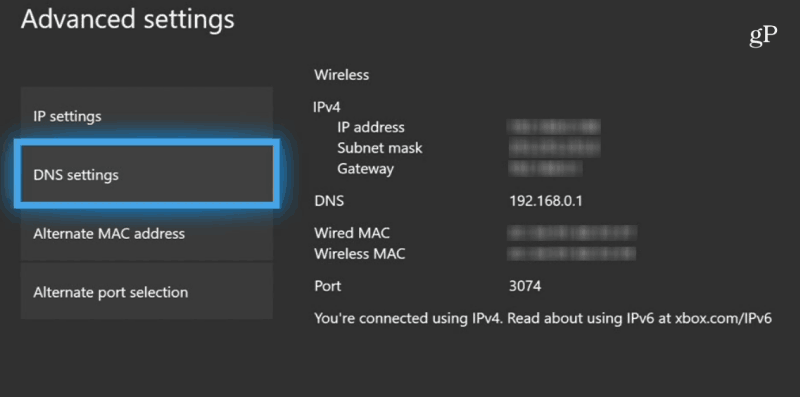 Xbox One DNS Settings